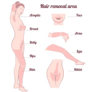 hair-removal-areas-infographic